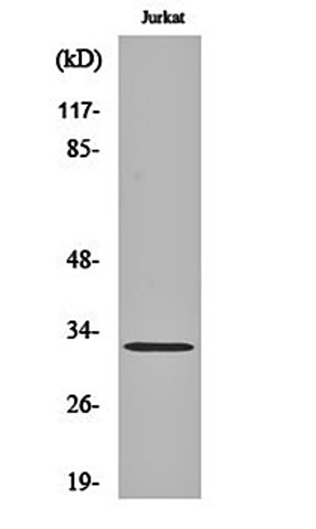 Western blot analysis of Jurkat cell lysates using DREAM antibody