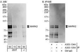 Detection of human MARK2 by western blot and immunoprecipitation.