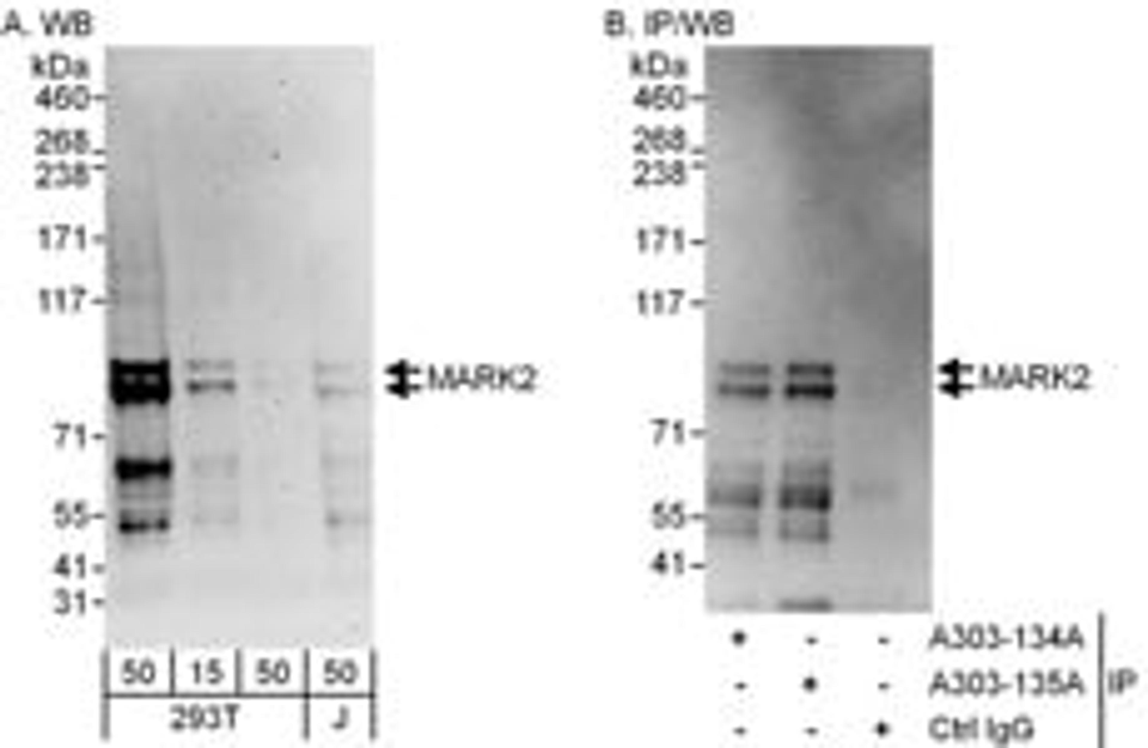 Detection of human MARK2 by western blot and immunoprecipitation.