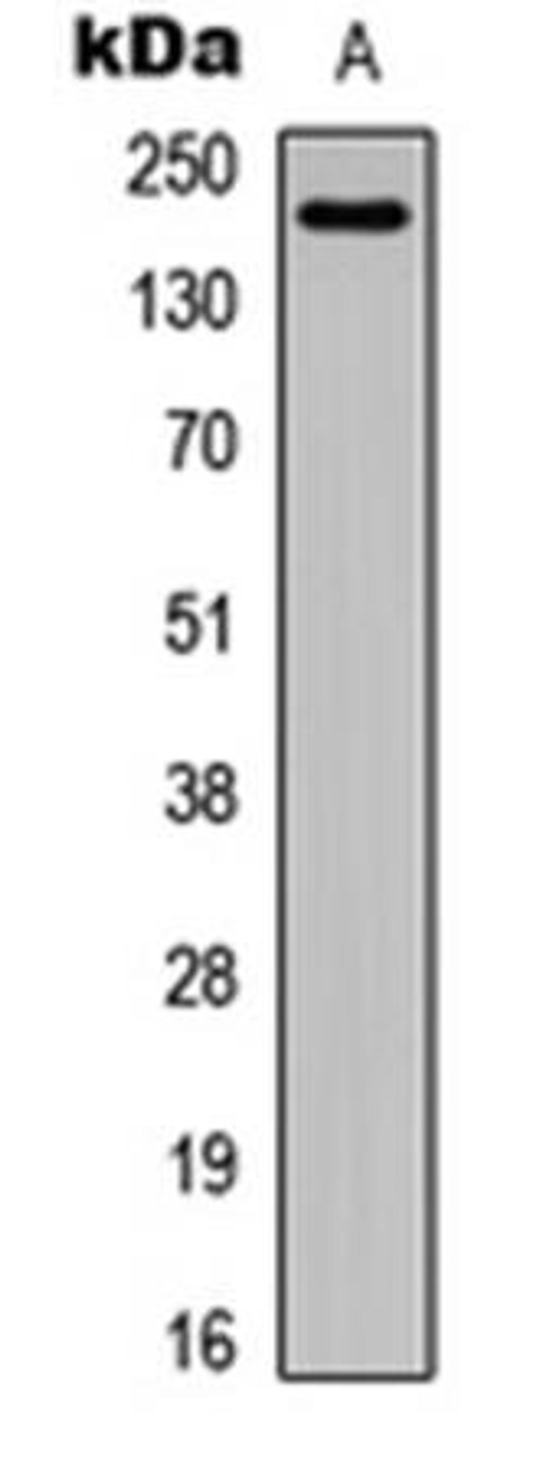 Western blot analysis of HeLa (Lane1) whole cell using Laminin alpha 4 antibody