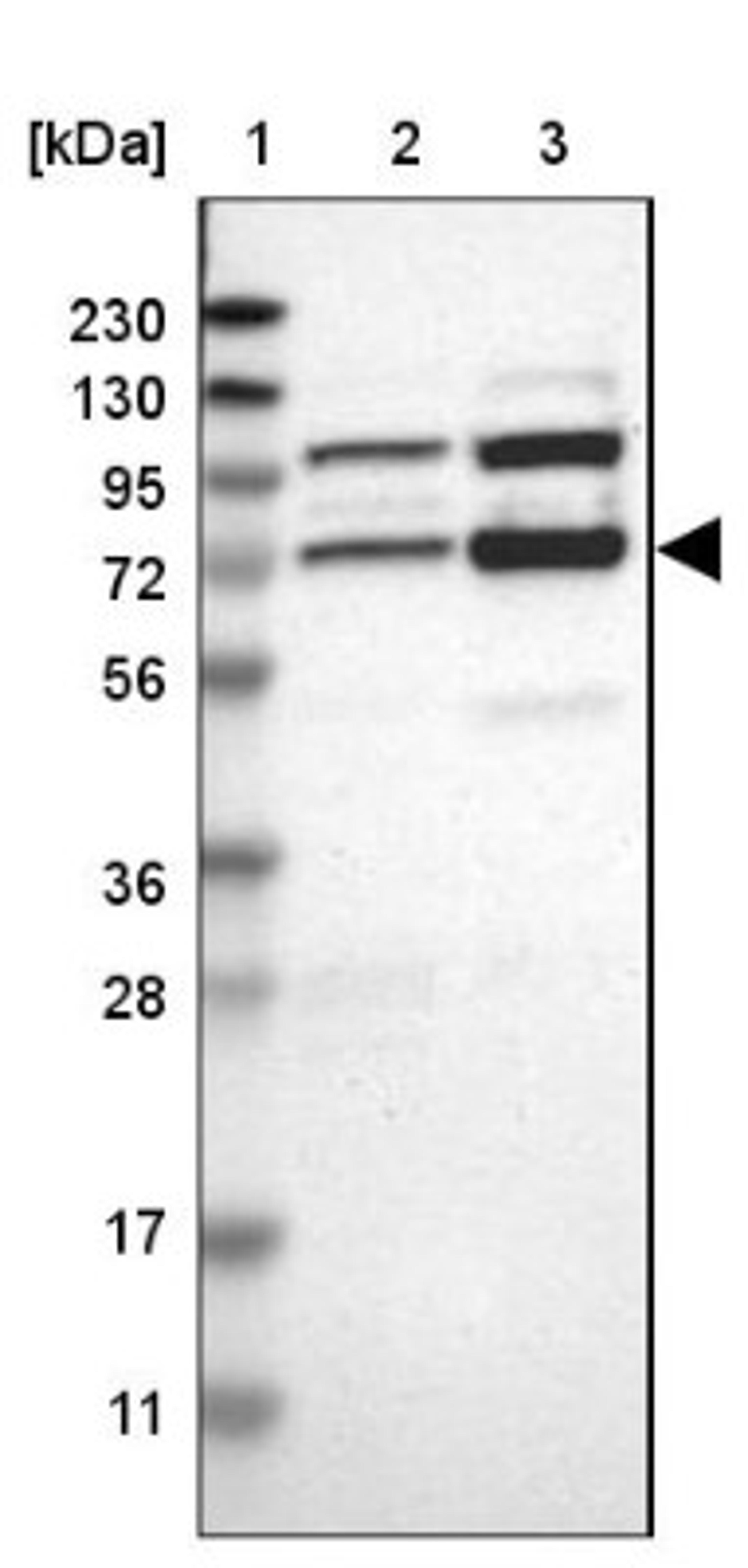 Western Blot: RBM14 Antibody [NBP1-84416] - Lane 1: Marker [kDa] 230, 130, 95, 72, 56, 36, 28, 17, 11<br/>Lane 2: Human cell line RT-4<br/>Lane 3: Human cell line U-251MG sp