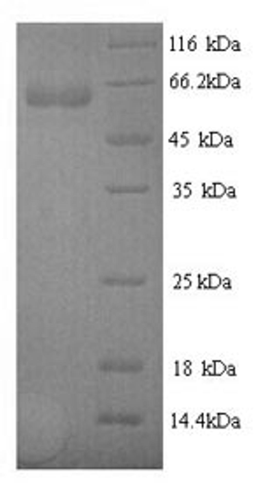 (Tris-Glycine gel) Discontinuous SDS-PAGE (reduced) with 5% enrichment gel and 15% separation gel.