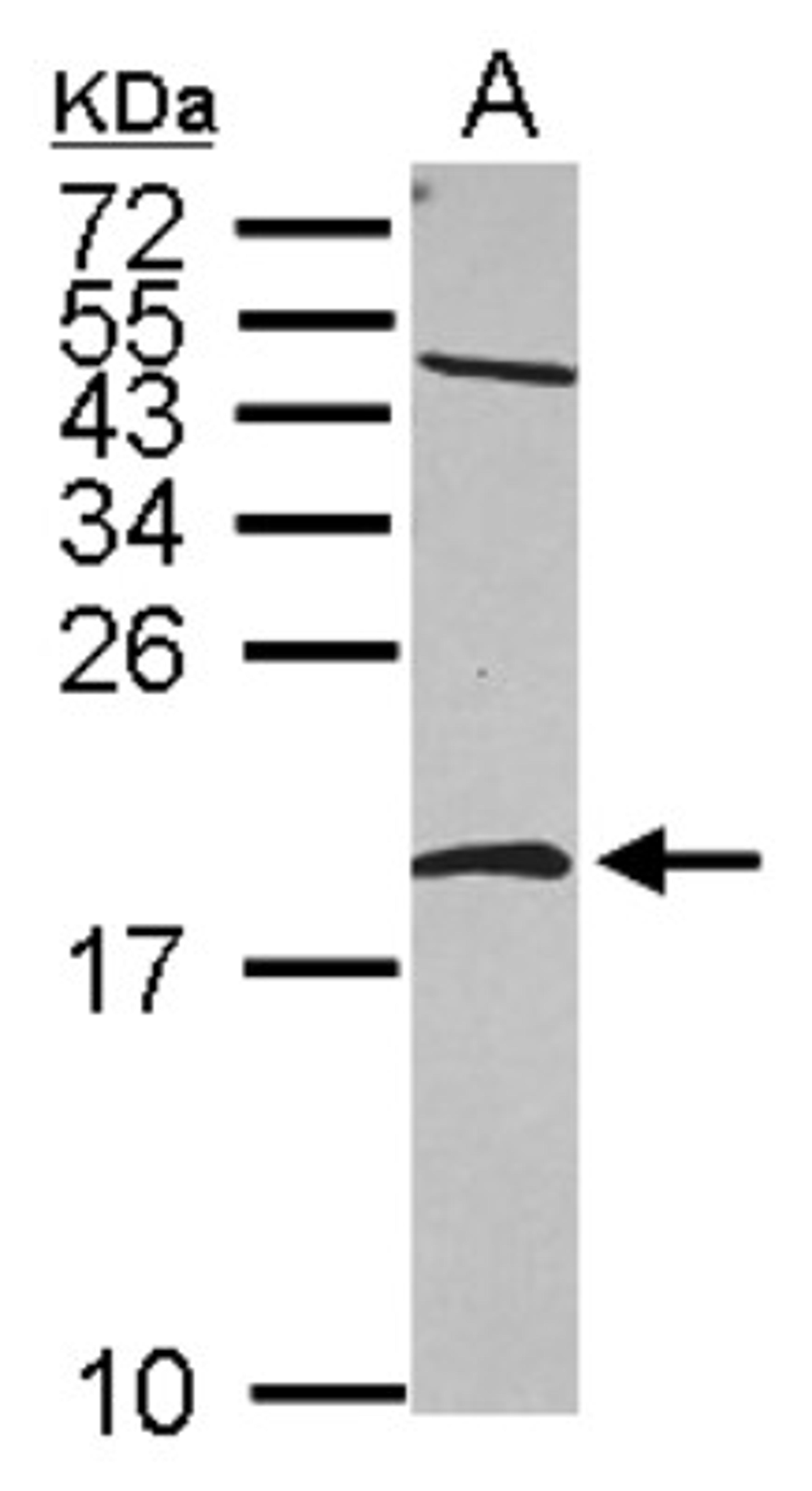 Western Blot: NME2 Antibody [NBP2-19553] - Sample (30 ug of whole cell lysate) A: A549 15% SDS PAGE gel, diluted at 1:1000.