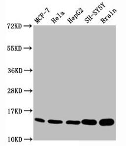 Western Blot. Positive WB detected in MCF-7 whole cell lysate锛孒ela whole cell lysate锛孒epG2 whole cell lysate锛孲H-SY5Y whole cell lysate,Rat brain tissue. All lanes Mono-methyl-Histone H3.1(K18)antibody at 0.7μg/ml. Secondary. Goat polyclonal to rabbit IgG at 1/50000 dilution. Predicted band size: 15 KDa. Observed band size: 15 KDa. 