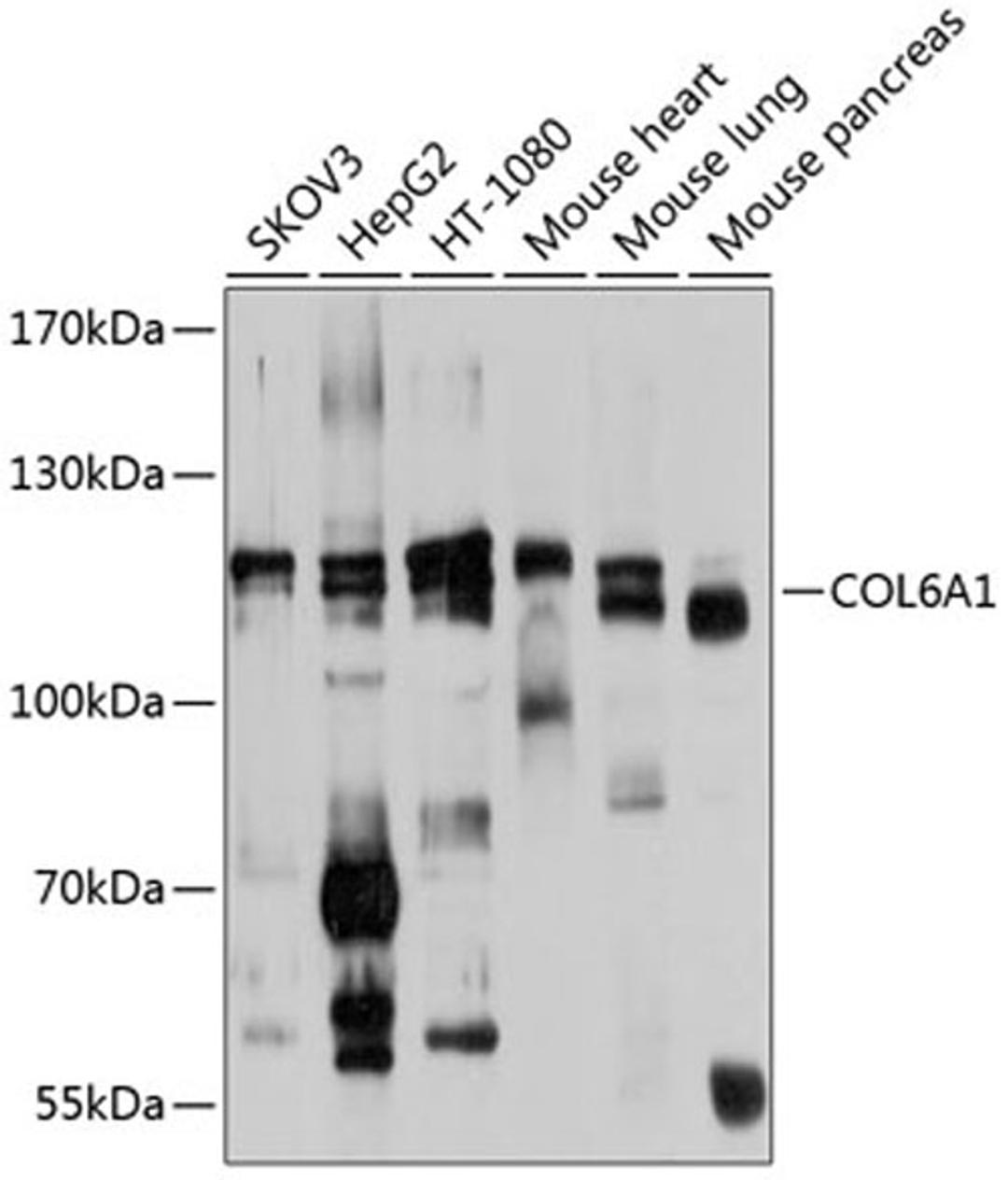 Western blot - COL6A1 antibody (A9236)