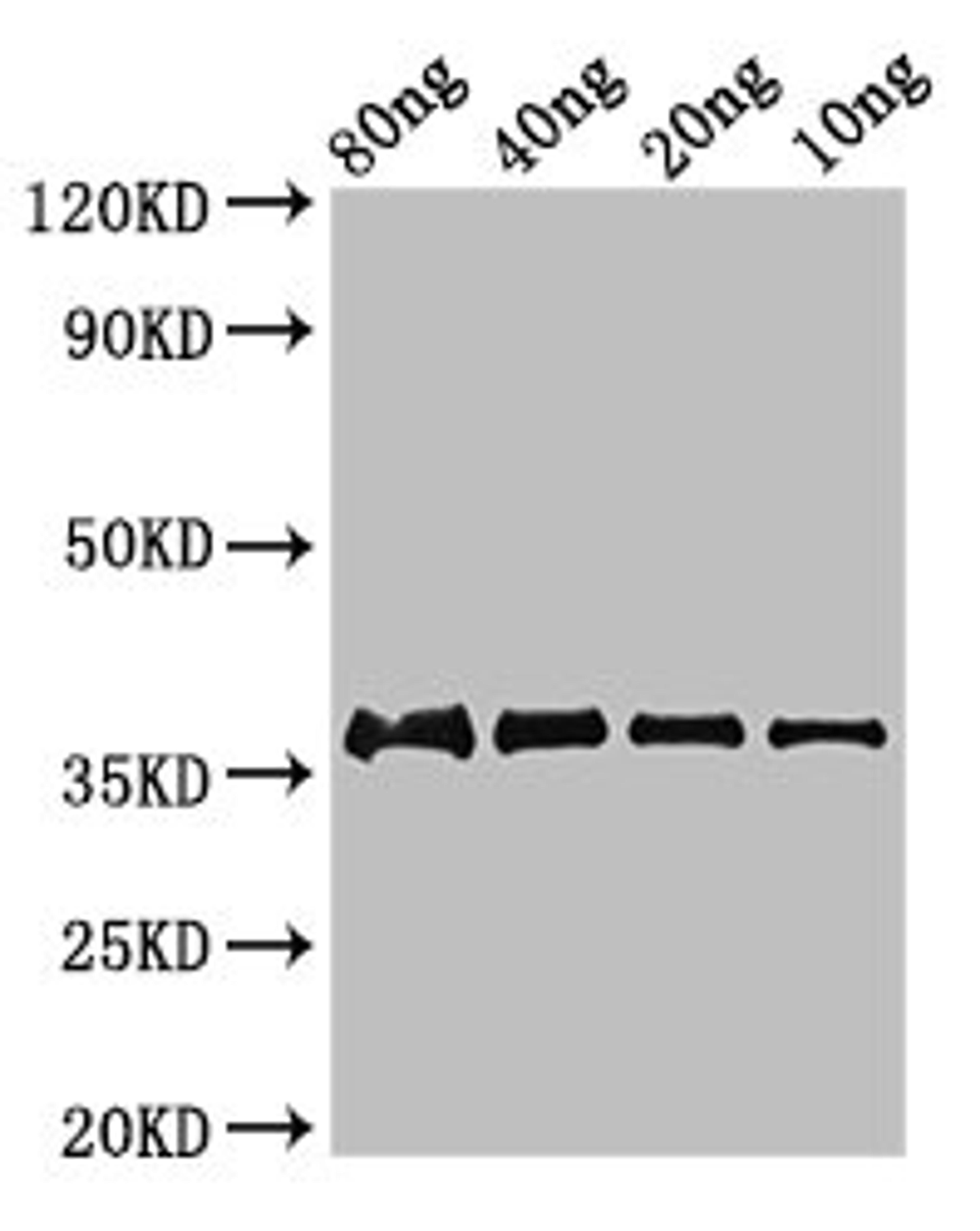 Western Blot. Positive WB detected in Recombinant protein. All lanes: fbpC antibody at 2.8µg/ml. Secondary. Goat polyclonal to rabbit IgG at 1/50000 dilution. Predicted band size: 37 kDa. Observed band size: 37 kDa