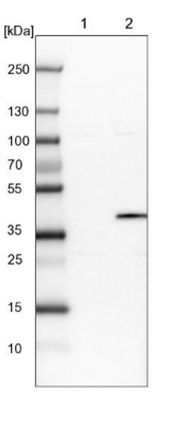 Western Blot: OGFOD2 Antibody [NBP1-82253] - Lane 1: NIH-3T3 cell lysate (Mouse embryonic fibroblast cells)<br/>Lane 2: NBT-II cell lysate (Rat Wistar bladder tumour cells)