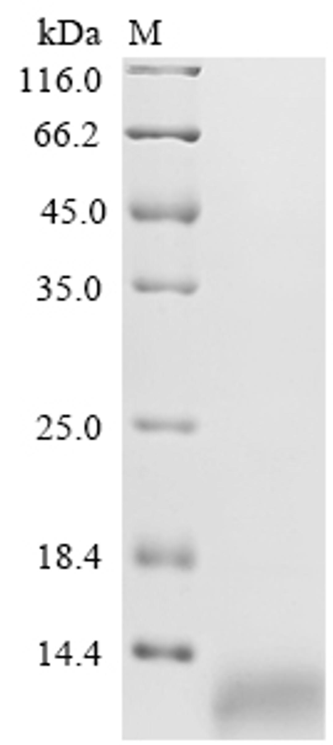 (Tris-Glycine gel) Discontinuous SDS-PAGE (reduced) with 5% enrichment gel and 15% separation gel.
