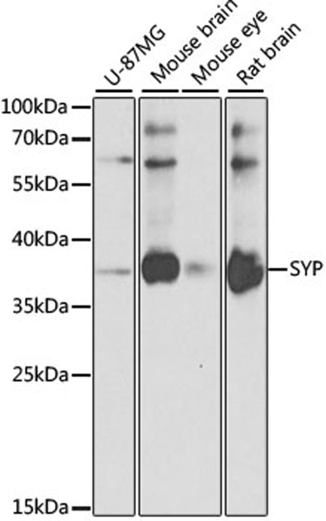 Western blot - SYP antibody (A6344)