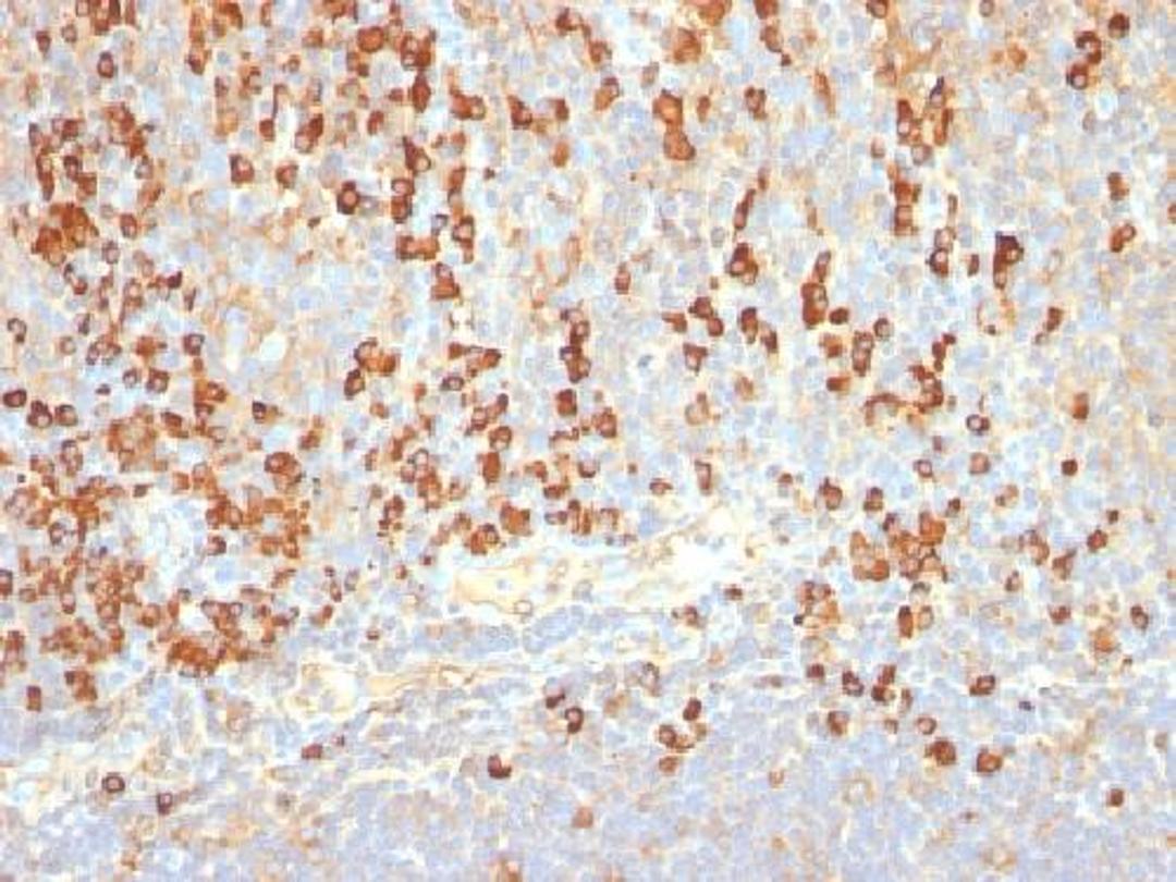 Immunohistochemical staining of human Tonsil tissue using Plasma Cell Marker antibody