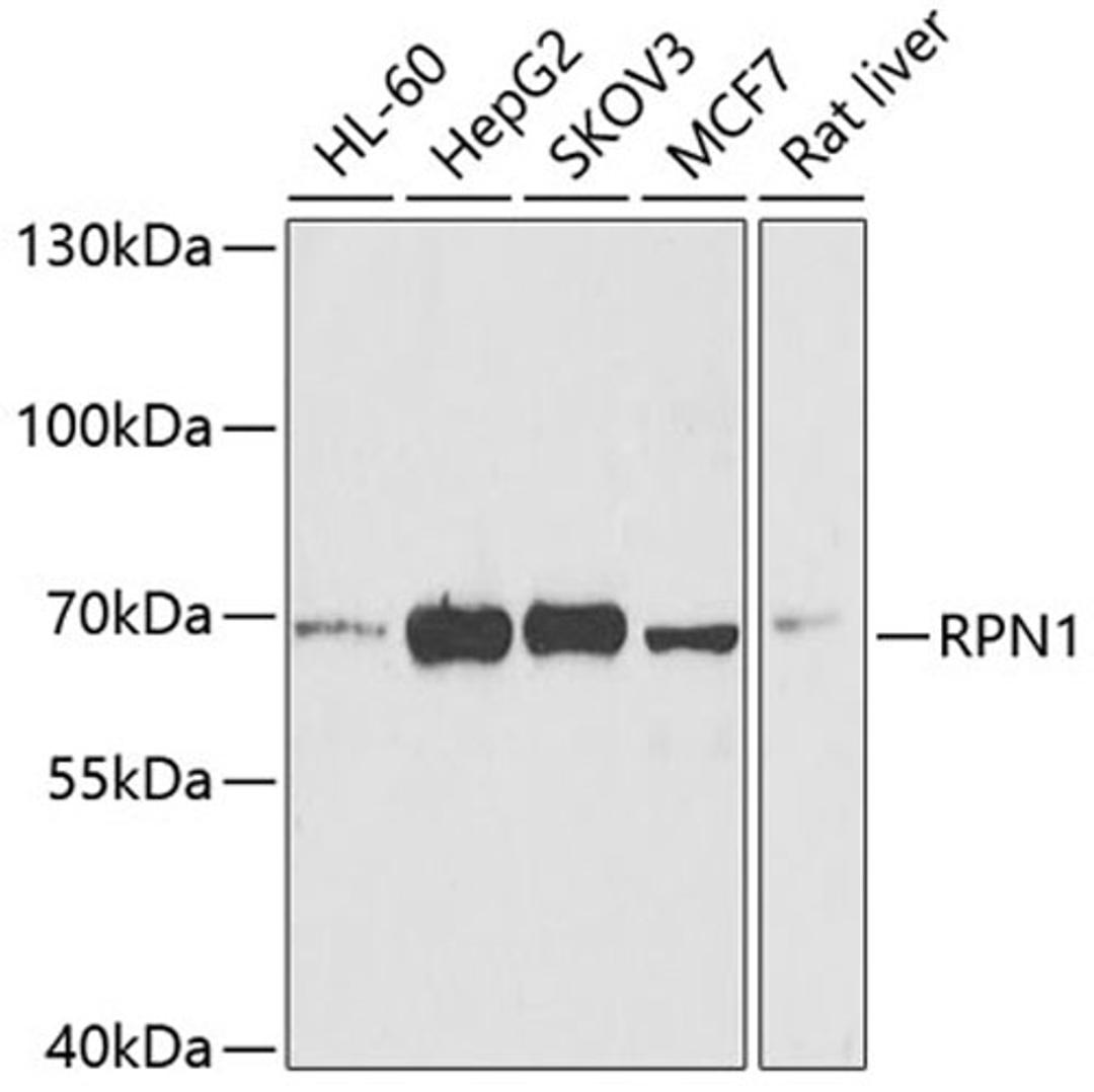 Western blot - RPN1 antibody (A6726)