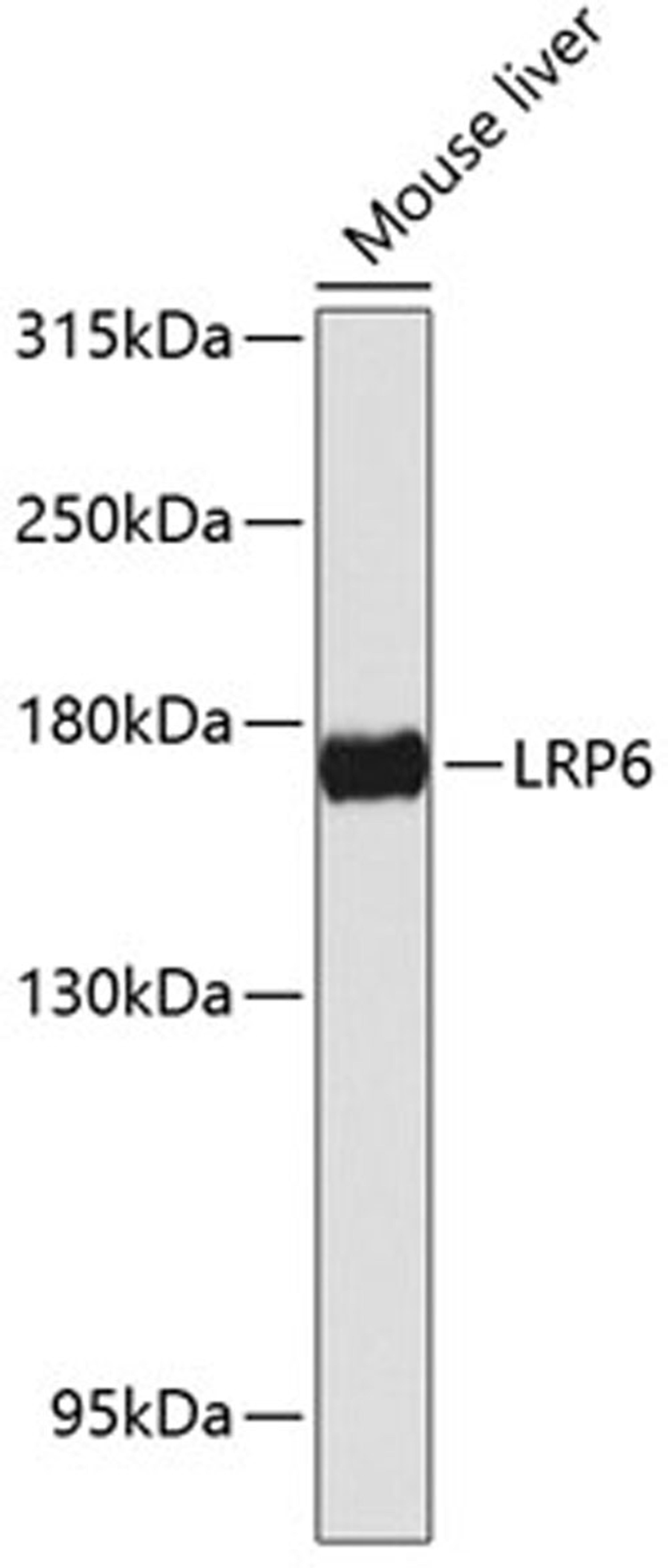 Western blot - LRP6 antibody (A13324)