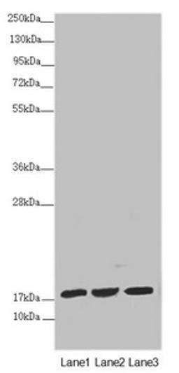 Western blot. All lanes: NDUFA12 antibody at 3.23 ug/ml. Lane 1: Mouse heart tissue. Lane 2: Mouse liver tissue. Lane 3: Mouse kidney tissue. Secondary. Goat polyclonal to rabbit IgG at 1/10000 dilution. Predicted band size: 18, 8 kDa. Observed band size: 20 kDa. 