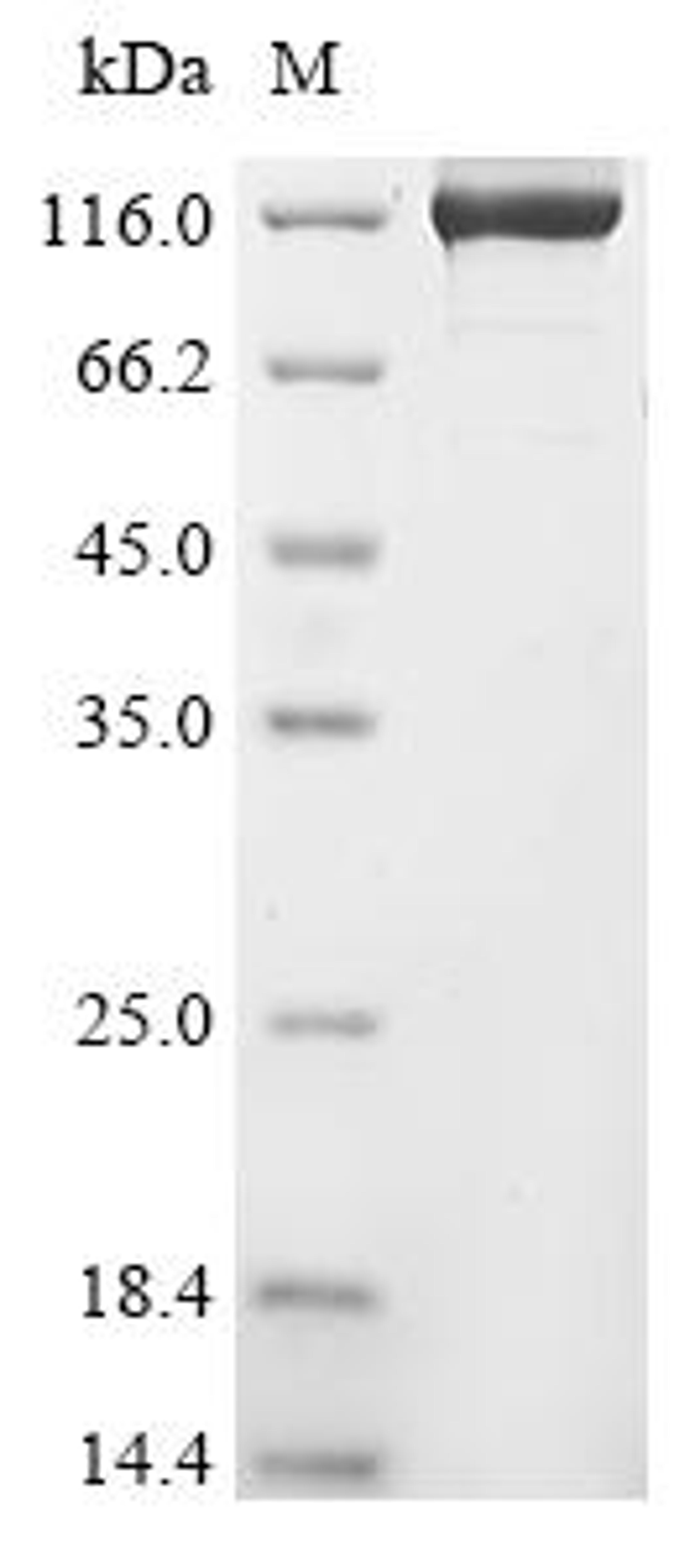 (Tris-Glycine gel) Discontinuous SDS-PAGE (reduced) with 5% enrichment gel and 15% separation gel.