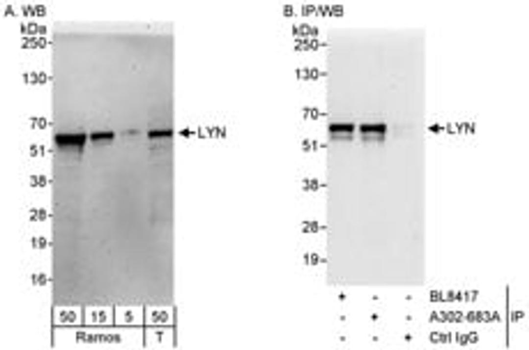 Detection of human LYN by western blot and immunoprecipitation.