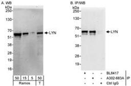 Detection of human LYN by western blot and immunoprecipitation.