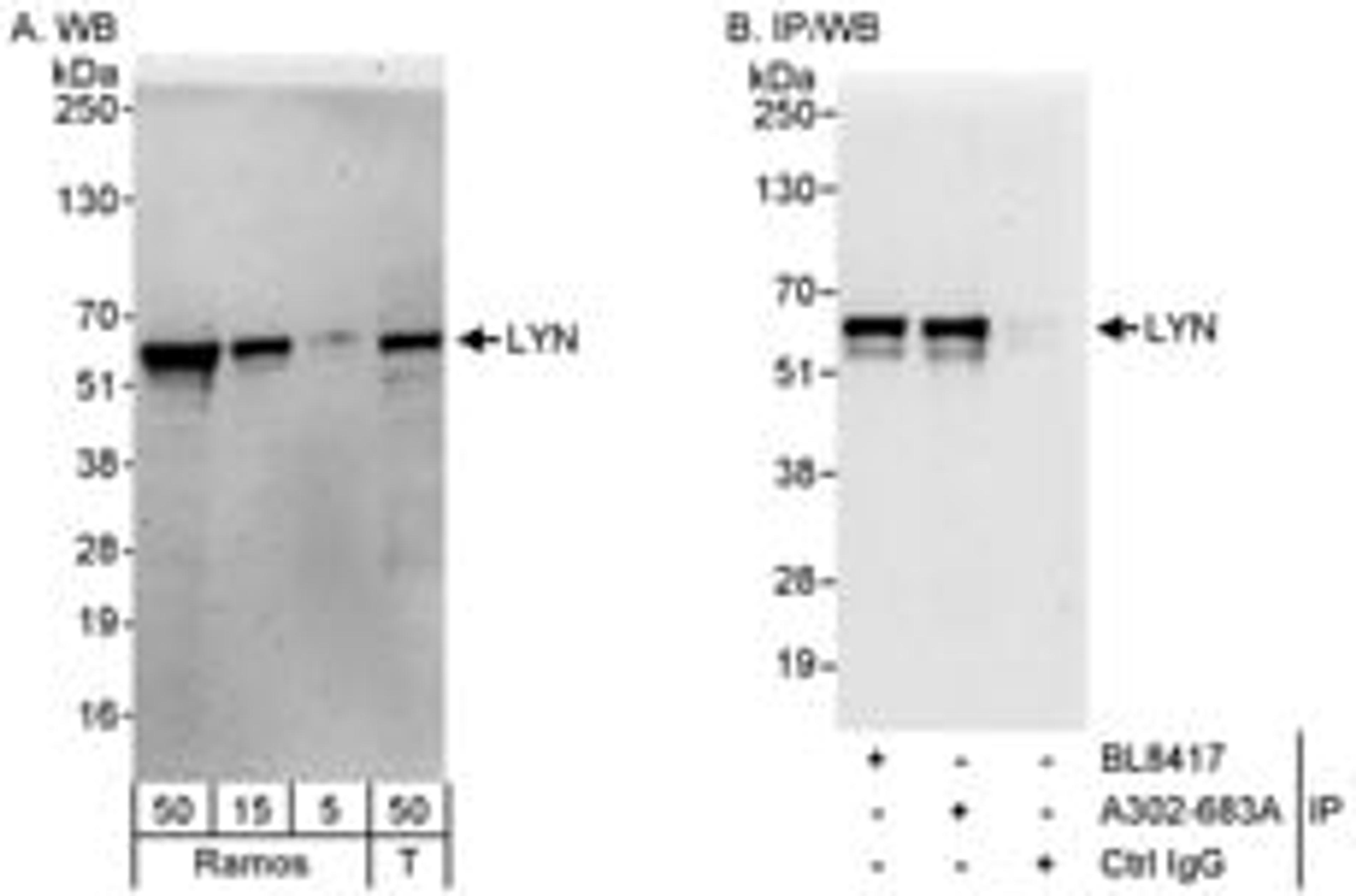 Detection of human LYN by western blot and immunoprecipitation.