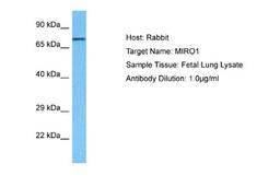 Western Blot: Rhot1 Antibody [NBP1-59021] - Fetal Lung lysates, Antibody Dilution: 1.0 ug/ml.