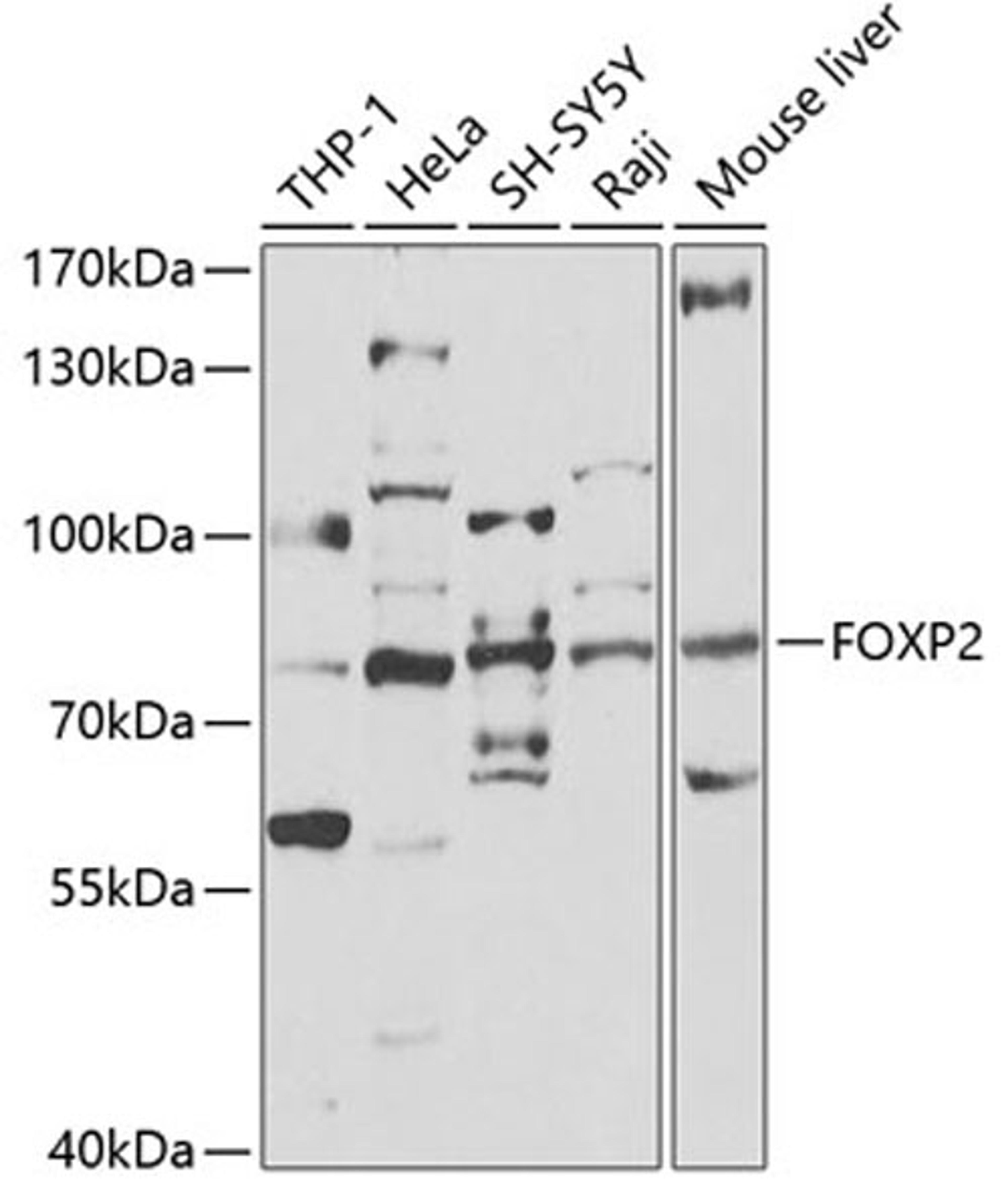 Western blot - FOXP2 antibody (A5677)