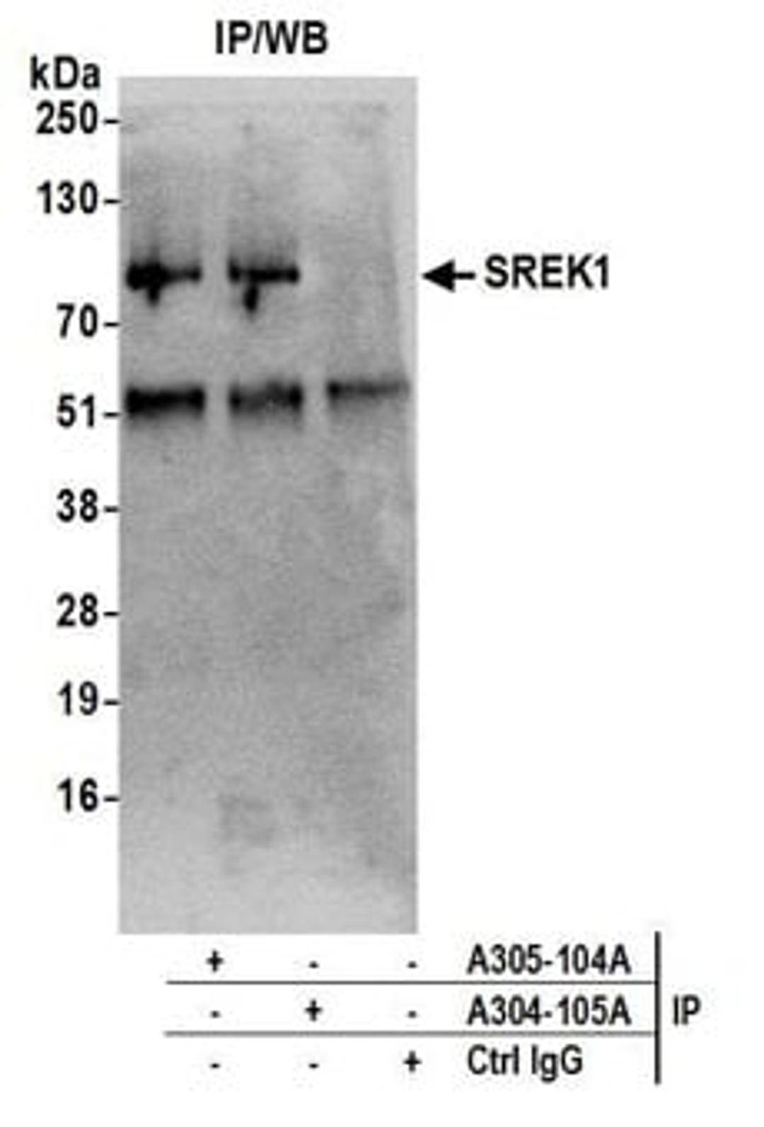 Detection of human SREK1 by western blot of immunoprecipitates.