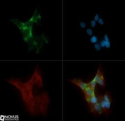 Immunocytochemistry/Immunofluorescence: PKC alpha Antibody (MC5) [NB600-201] - PKC alpha (MC5) antibody was tested in SH-SY5Y cells with Dylight 488 (green). Nuclei and beta-tubulin were counterstained with DAPI (blue) and Dylight 550 (red).