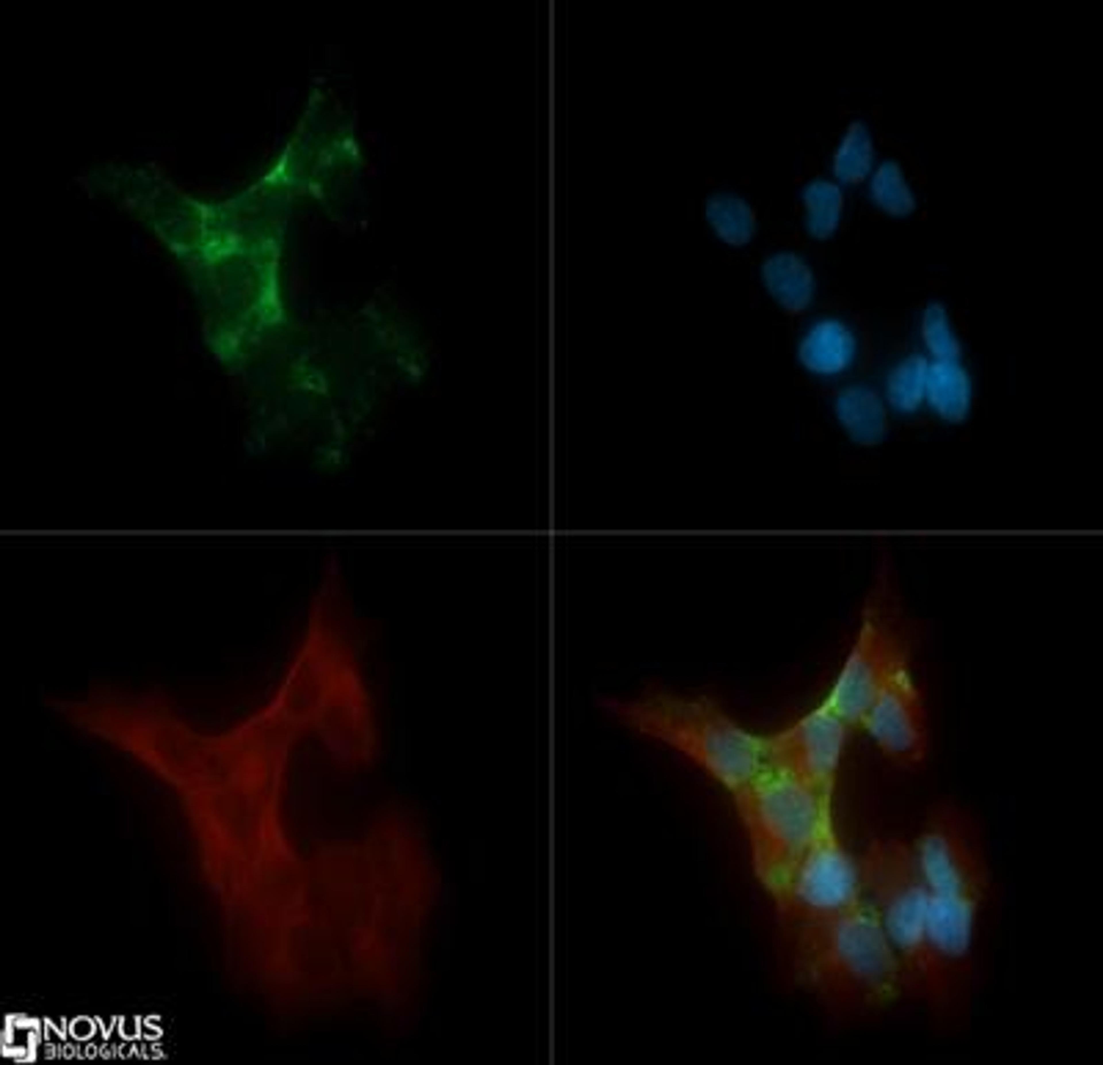 Immunocytochemistry/Immunofluorescence: PKC alpha Antibody (MC5) [NB600-201] - PKC alpha (MC5) antibody was tested in SH-SY5Y cells with Dylight 488 (green). Nuclei and beta-tubulin were counterstained with DAPI (blue) and Dylight 550 (red).