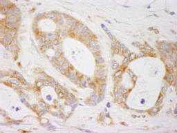 Detection of human EML4 by immunohistochemistry.