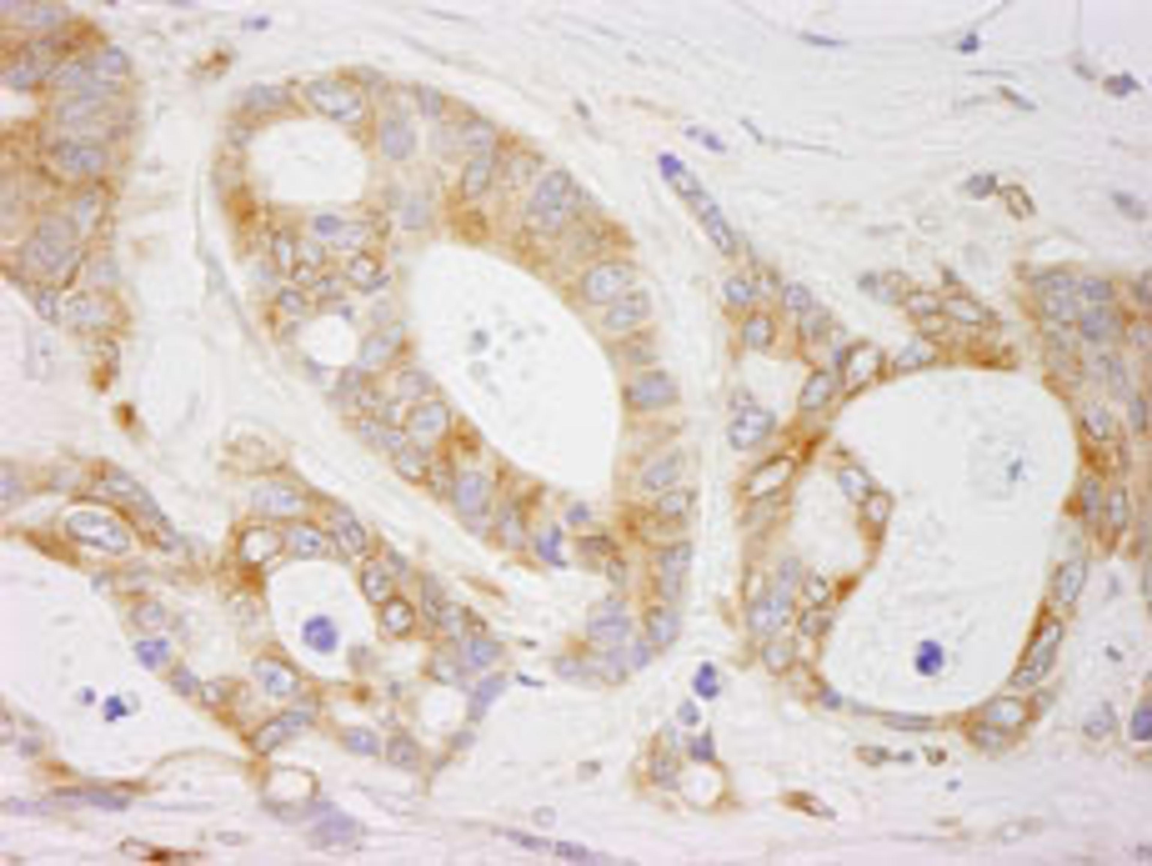 Detection of human EML4 by immunohistochemistry.