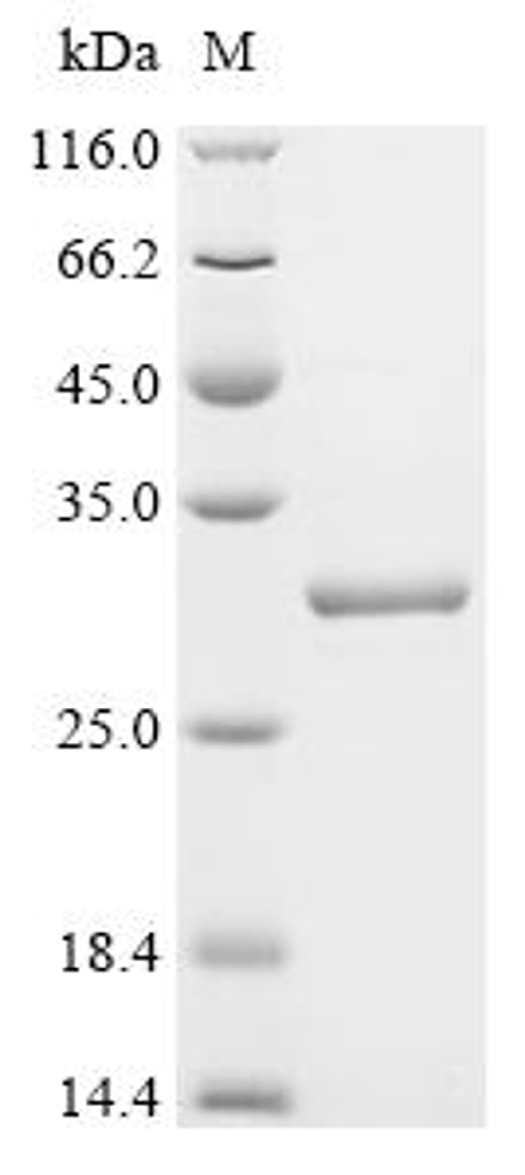 (Tris-Glycine gel) Discontinuous SDS-PAGE (reduced) with 5% enrichment gel and 15% separation gel.