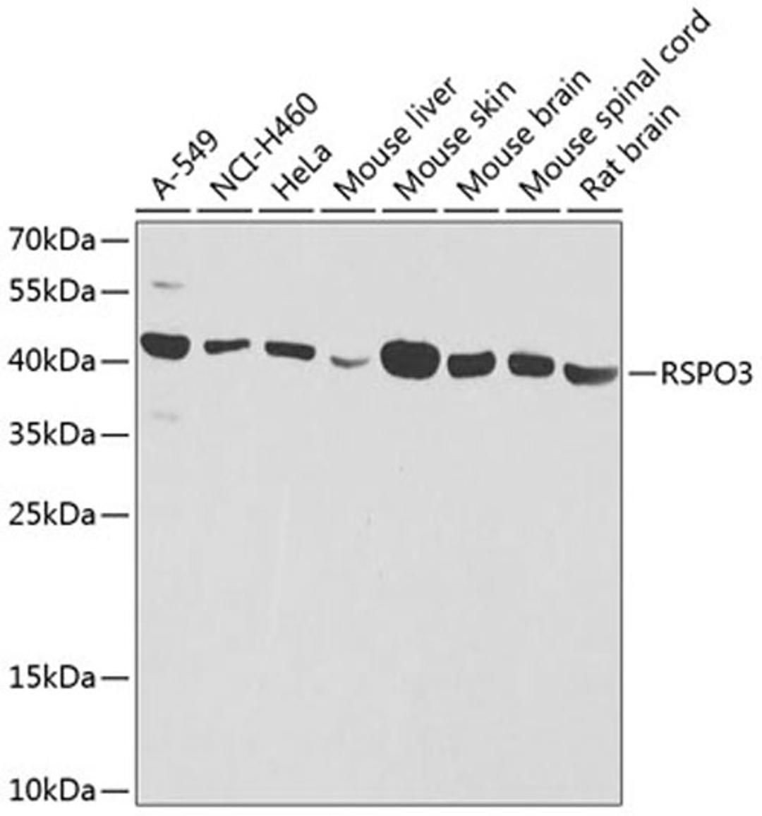 Western blot - RSPO3 antibody (A8389)