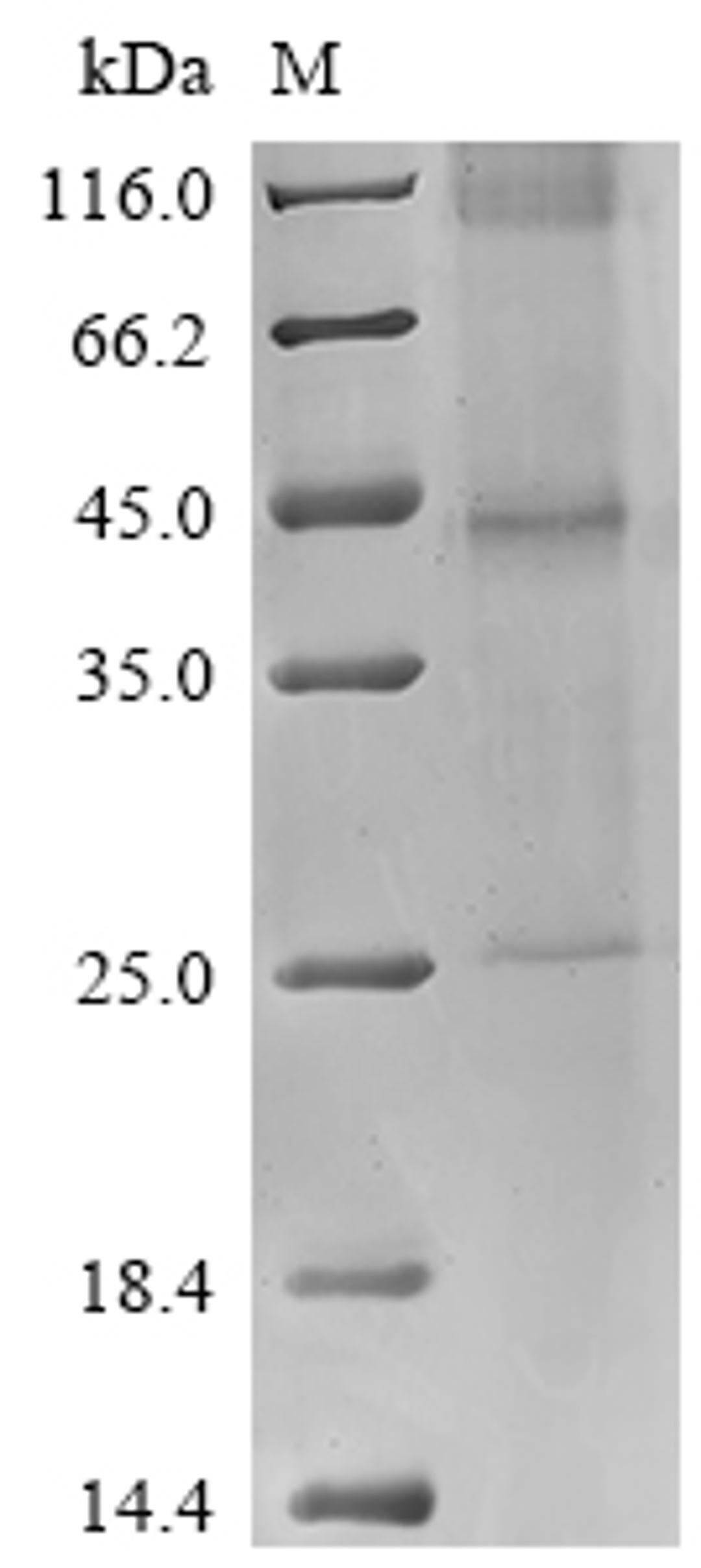 (Tris-Glycine gel) Discontinuous SDS-PAGE (reduced) with 5% enrichment gel and 15% separation gel.