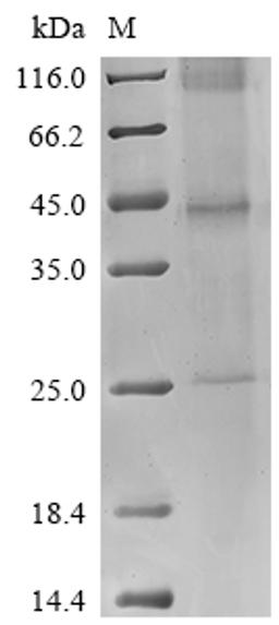(Tris-Glycine gel) Discontinuous SDS-PAGE (reduced) with 5% enrichment gel and 15% separation gel.
