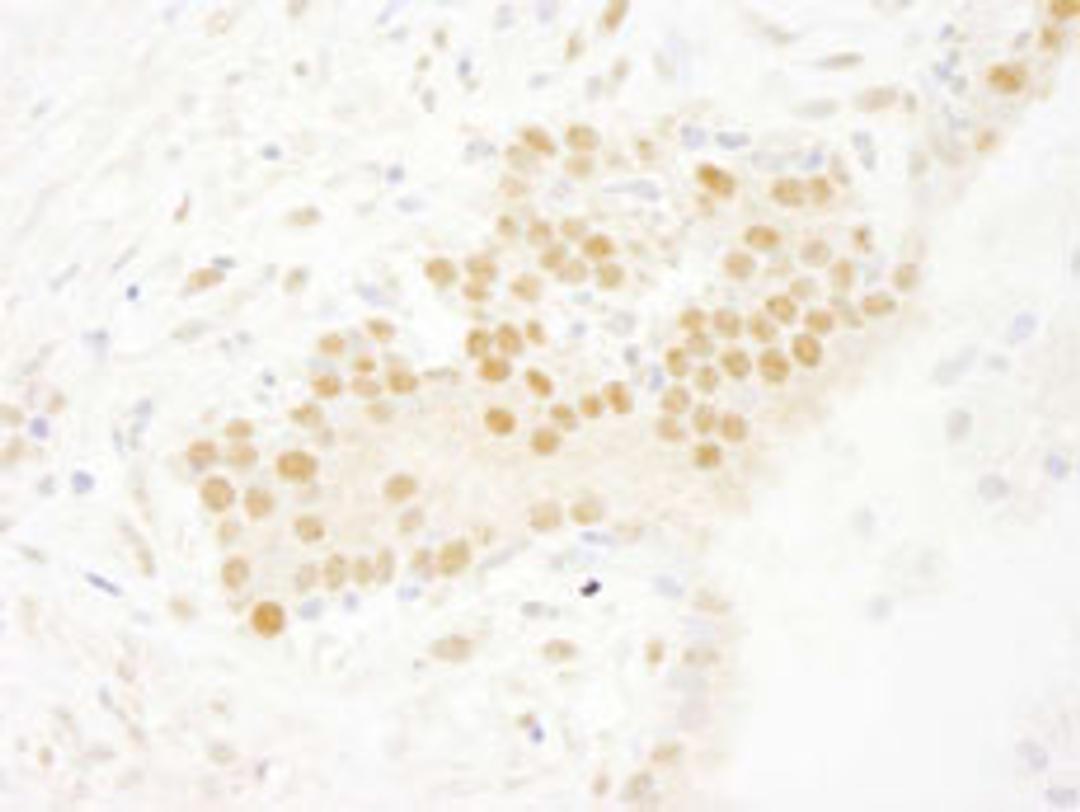 Detection of human SET7 by immunohistochemistry.