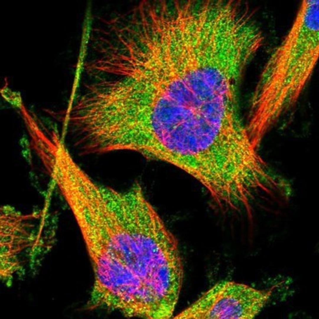 Immunocytochemistry/Immunofluorescence: HARBI1 Antibody [NBP1-88384] - Staining of human cell line U-251 MG shows positivity in cytoplasm.