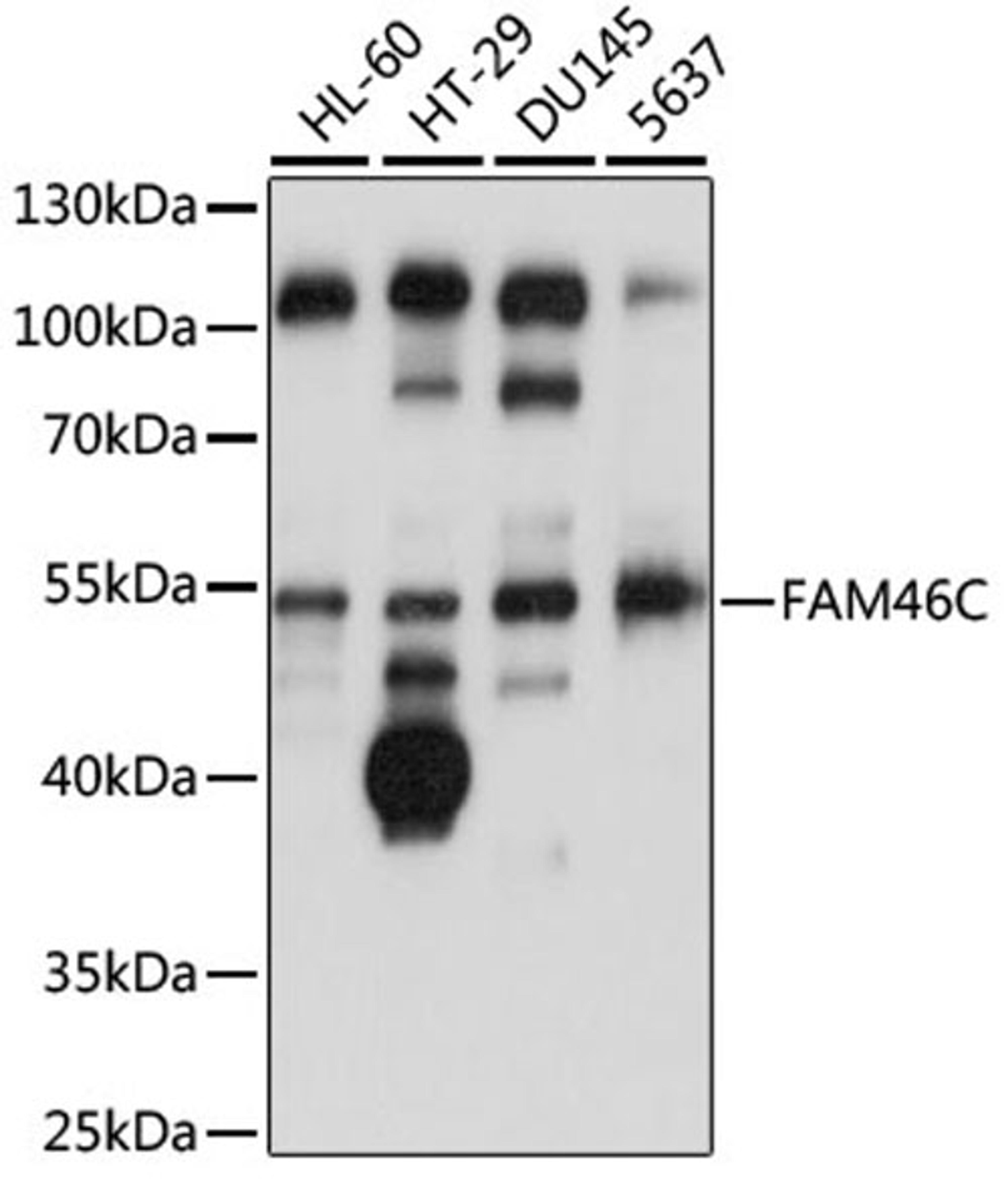 Western blot - FAM46C antibody (A14661)