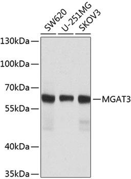 Western blot - MGAT3 antibody (A8134)