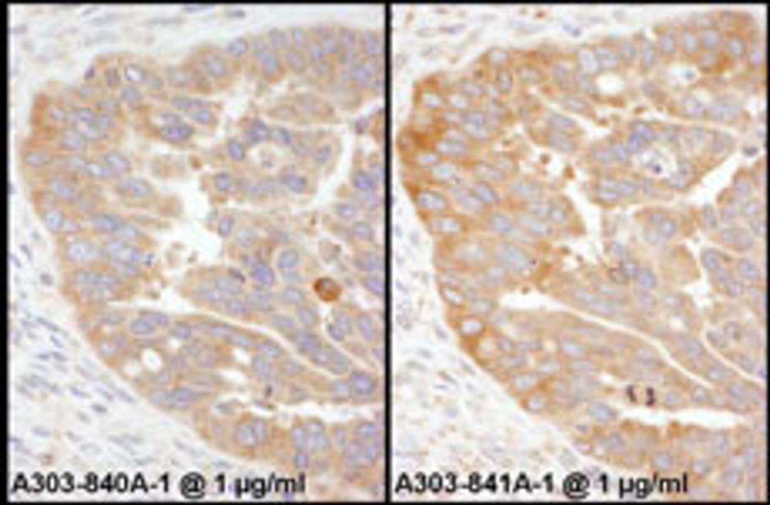 Detection of human RPS3 by immunohistochemistry.