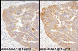 Detection of human RPS3 by immunohistochemistry.