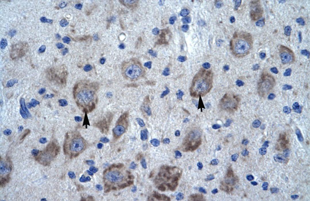 Antibody used in IHC on Human Brain.