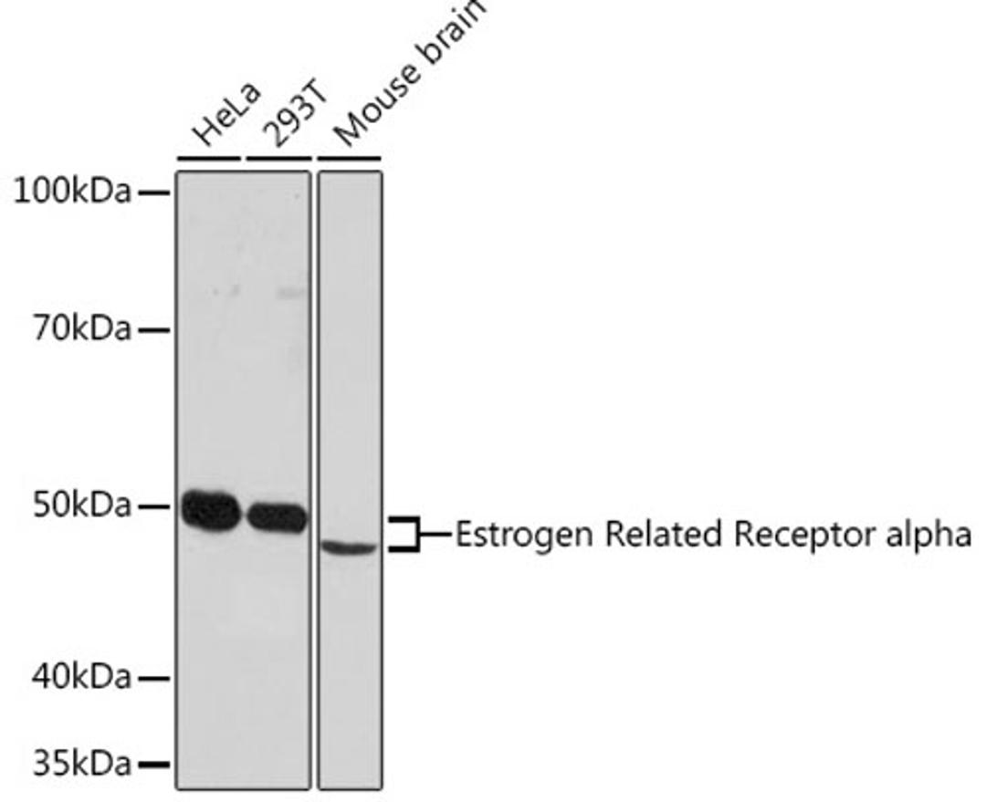 Western blot - Estrogen Related Receptor alpha Rabbit mAb (A4176)