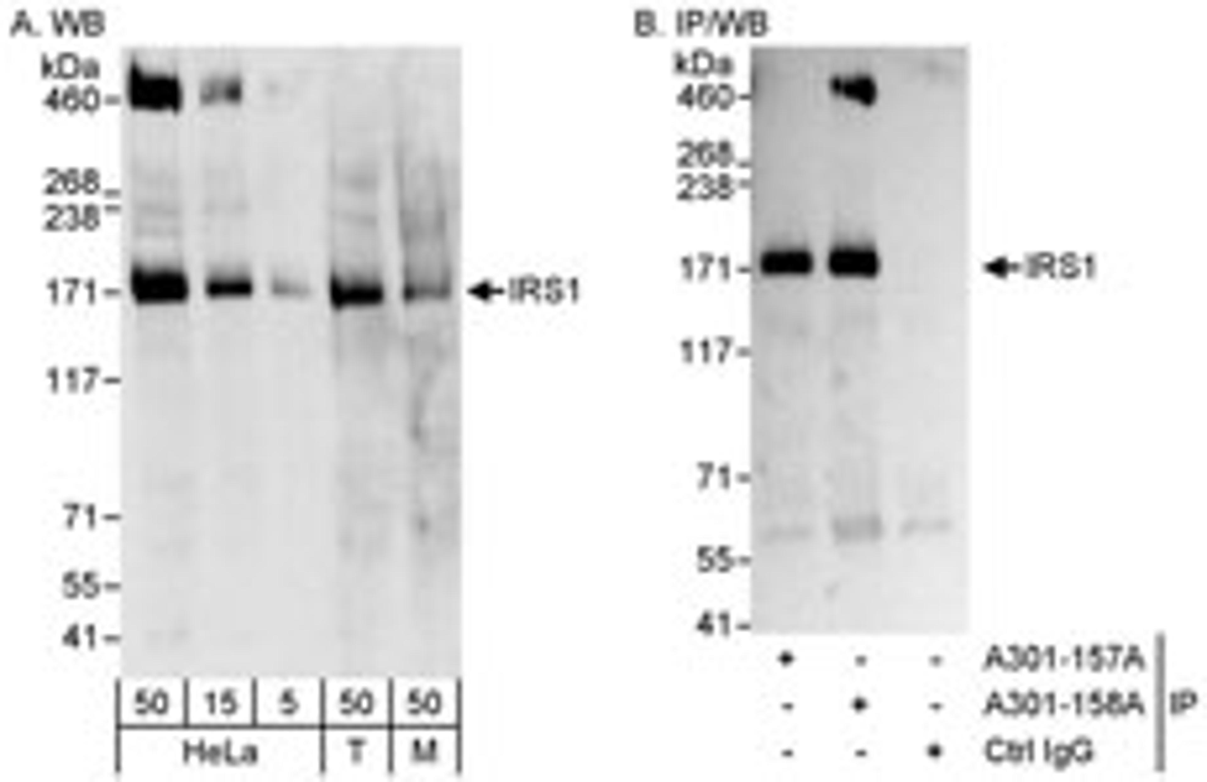 Detection of human and mouse IRS1 by western blot (h&m) and immunoprecipitation (h).