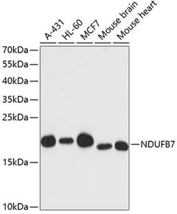 Western blot - NDUFB7 antibody (A13693)