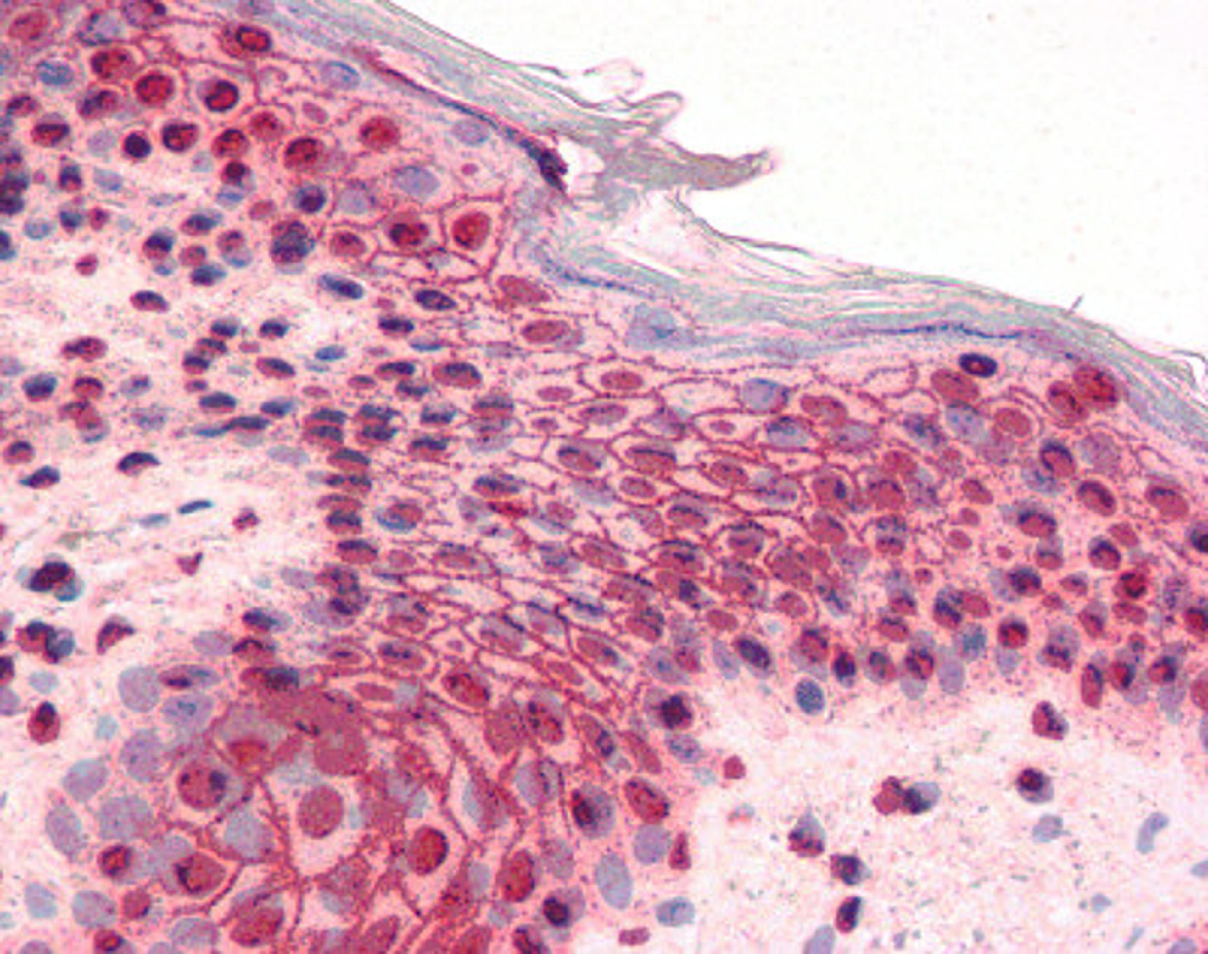 Immunohistochemistry staining of GLI2 in skin tissue using GLI2 Antibody.