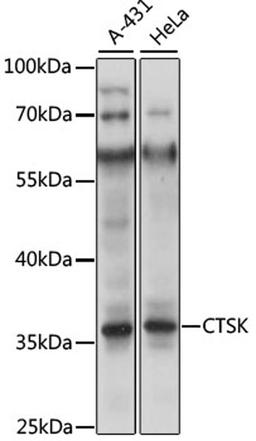 Western blot - CTSK antibody (A5871)