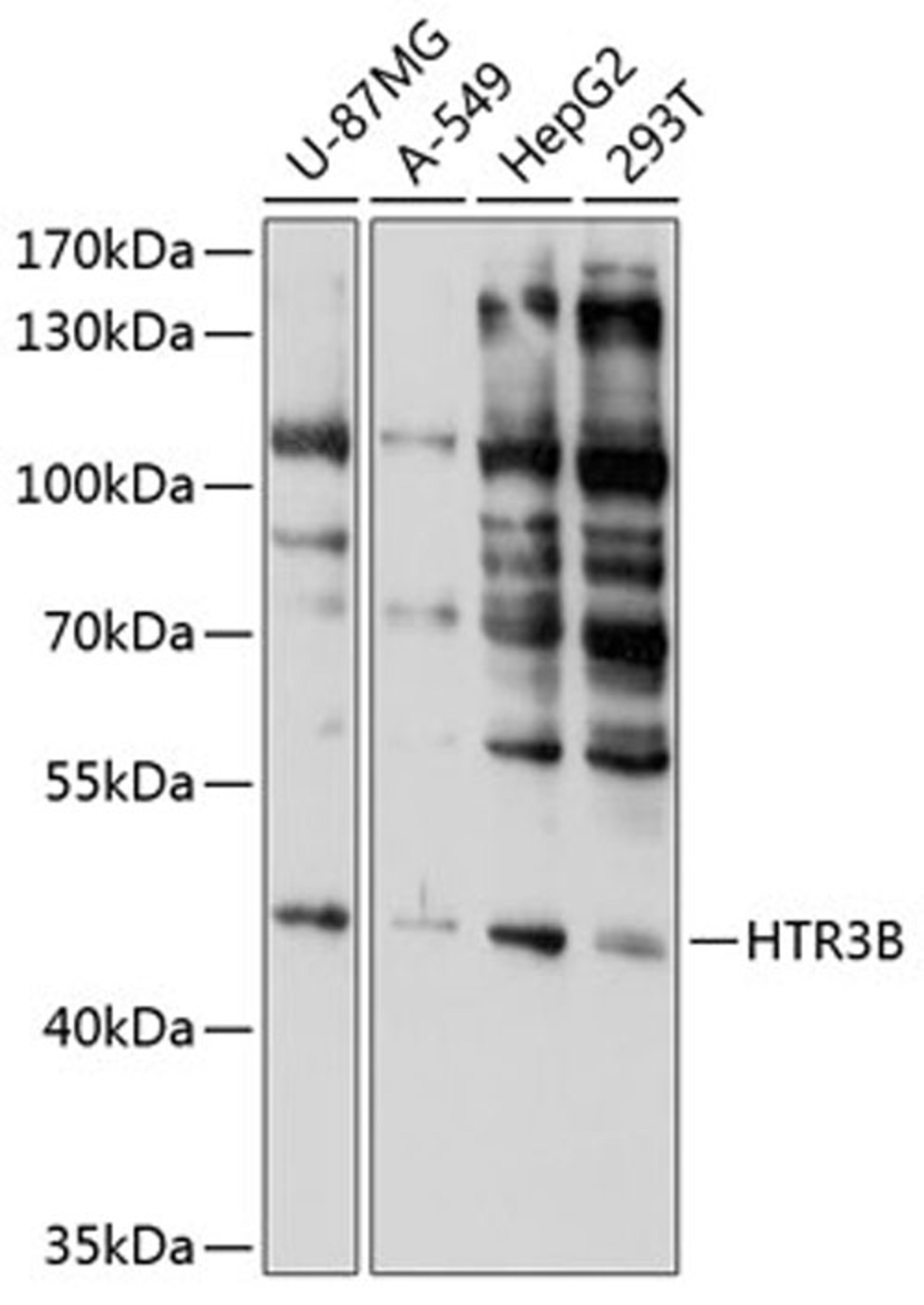 Western blot - HTR3B antibody (A10266)