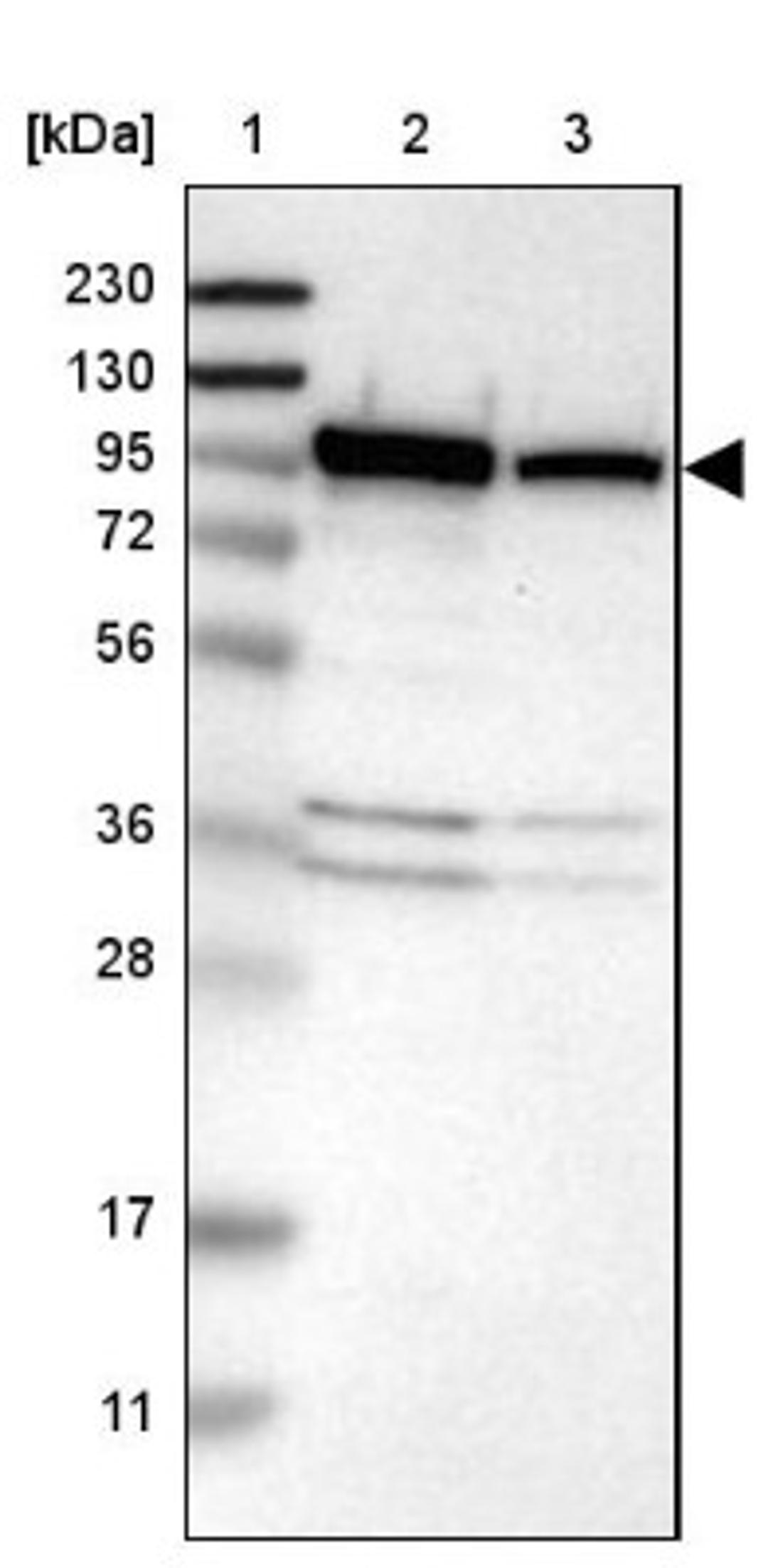 Western Blot: CTNNA3 Antibody [NBP1-82728] - Lane 1: Marker [kDa] 230, 130, 95, 72, 56, 36, 28, 17, 11<br/>Lane 2: Human cell line RT-4<br/>Lane 3: Human cell line U-251MG sp