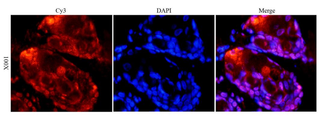 IF analysis of rat skin tissue using anti-TLR2 (dilution of primary antibody at 1:100)