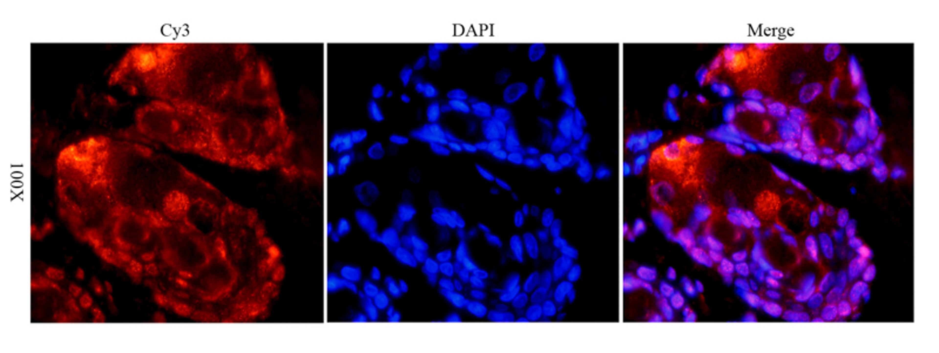 IF analysis of rat skin tissue using anti-TLR2 (dilution of primary antibody at 1:100)