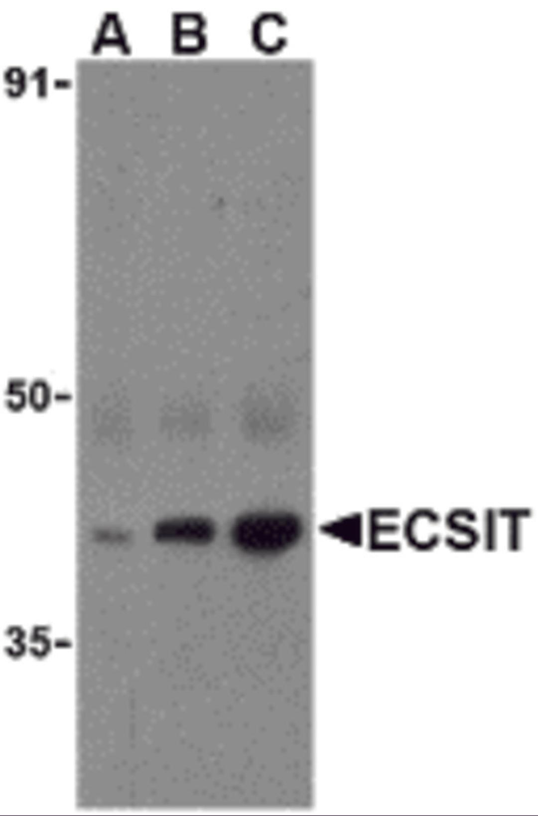 Western blot analysis of ECSIT in human heart cell lysates with ECSIT antibody at (A) 0.5, (B) 1, and (C) 2 μg/mL.
