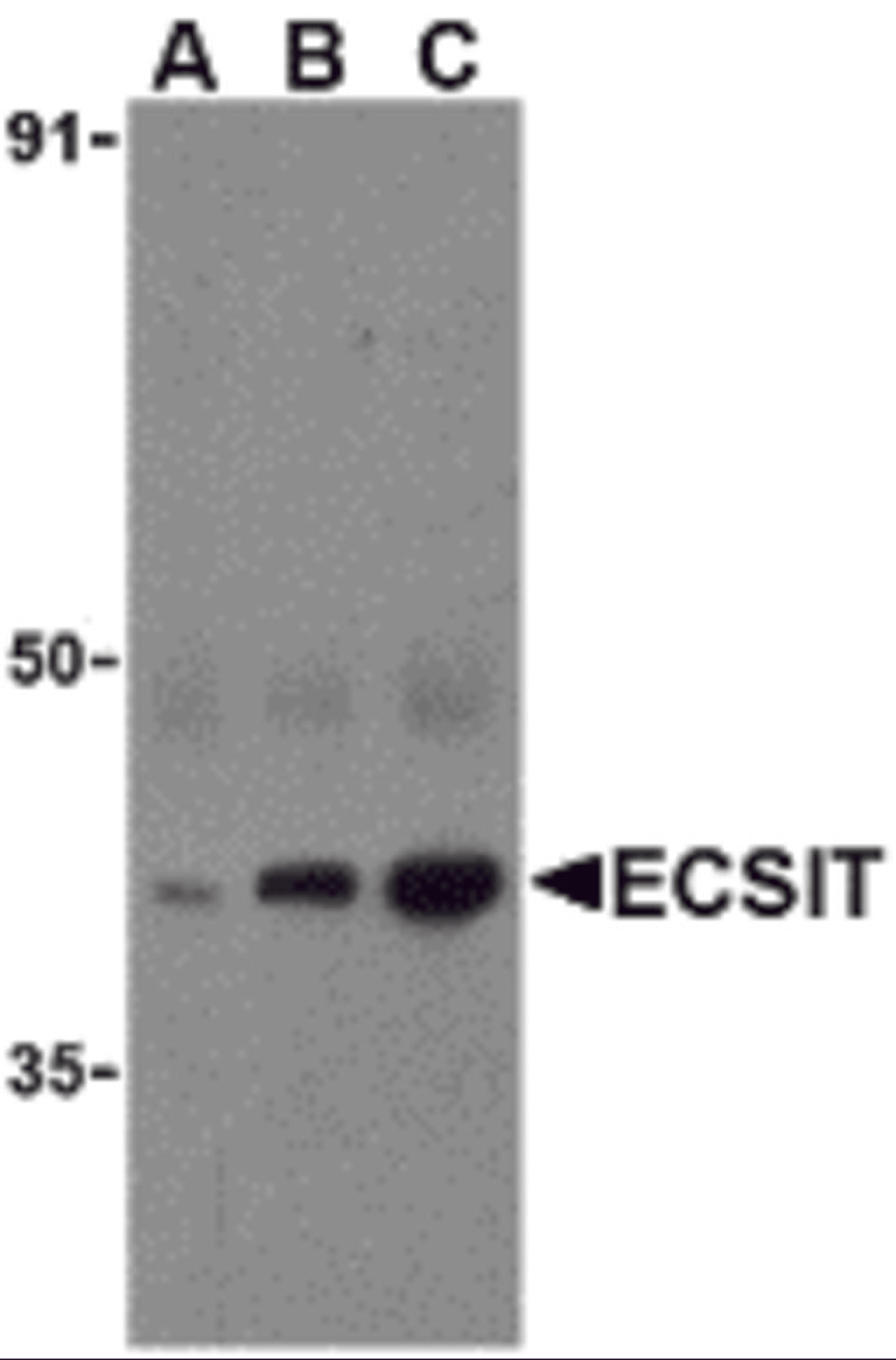 Western blot analysis of ECSIT in human heart cell lysates with ECSIT antibody at (A) 0.5, (B) 1, and (C) 2 μg/mL.